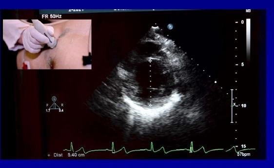 CARDIAC_demo_patient_short_axis