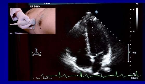 CARDIAC_demo_patient_short_axis
